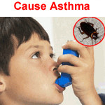 Cockroaches-cause-asthma